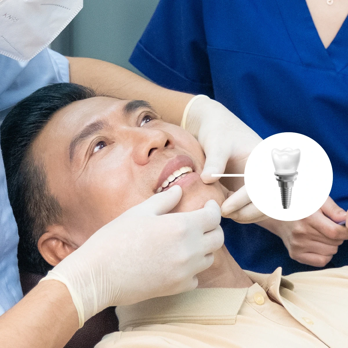 Dental Implant